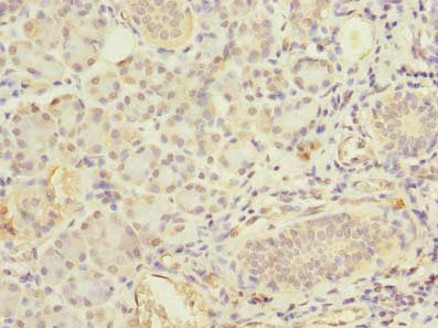 Fchsd2 Polyclonal Antibody - image 4