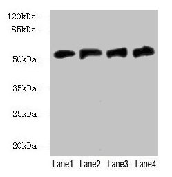 Immunohistochemistry of paraffin-embedded human adrenal gland tissue using CAC08434 at dilution of 1:100