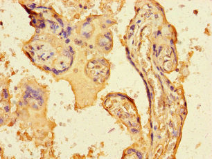 Immunohistochemistry of paraffin-embedded human appendix tissue using CAC08436 at dilution of 1:100