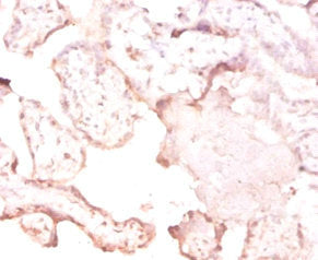 Ftsj1 Polyclonal Antibody - image 3