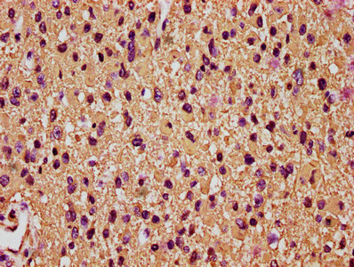 IHC image diluted at 1:200 and staining in paraffin-embedded human brain tissue performed on a Leica BondTM system. After dewaxing and hydration, antigen retrieval was mediated by high pressure in a citrate buffer (pH 6.0). Section was blocked with 10% normal goat serum 30min at RT. Then primary antibody (1% BSA) was incubated at 4°C overnight. The primary is detected by a biotinylated secondary antibody and visualized using an HRP conjugated SP system.