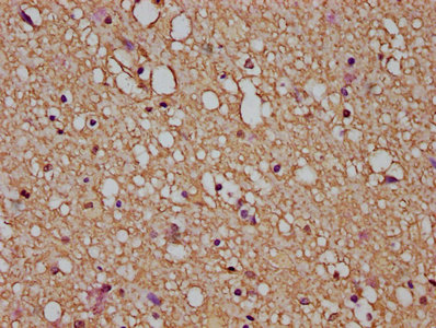 Immunofluorescence staining of A549 cells with CAC08463 at 1:66, counter-stained with DAPI. The cells were fixed in 4% formaldehyde, permeabilized using 0.2% Triton X-100 and blocked in 10% normal Goat Serum. The cells were then incubated with the antibody overnight at 4°C. The secondary antibody was Alexa Fluor 488-congugated AffiniPure Goat Anti-Rabbit IgG(H+L).