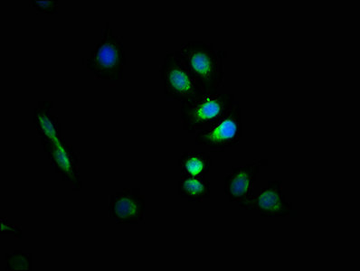Gfap Polyclonal Antibody - image 5