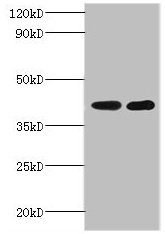 Glt8D2 Polyclonal Antibody - image 2