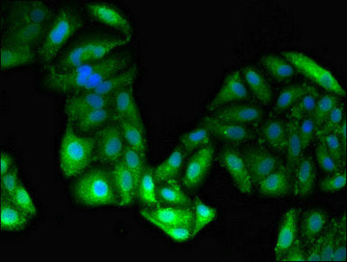 Western Blot; , Positive WB detected in: HepG2 whole cell lysate, Rat liver tissue, Mouse liver tissue; , All lanes: GPT antibody at 4.5µg/ml; , Secondary; , Goat polyclonal to rabbit IgG at 1/50000 dilution; , Predicted band size: 55 kDa; , Observed band size: 55 kDa