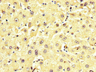 Gpt Polyclonal Antibody - image 5