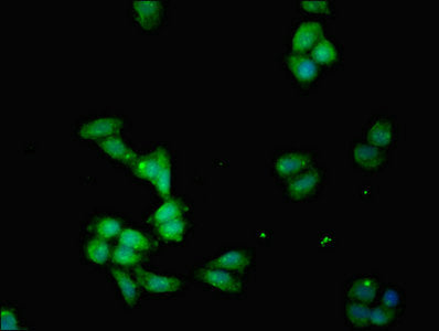 Western Blot; , Positive WB detected in: U87 whole cell lysate; , All lanes: IDO1 antibody at 2.6µg/ml; , Secondary; , Goat polyclonal to rabbit IgG at 1/50000 dilution; , Predicted band size: 46 kDa; , Observed band size: 46 kDa