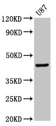 Immunofluorescence staining of Hela cells with CAC08537 at 1:266, counter-stained with DAPI. The cells were fixed in 4% formaldehyde, permeabilized using 0.2% Triton X-100 and blocked in 10% normal Goat Serum. The cells were then incubated with the antibody overnight at 4°C. The secondary antibody was Alexa Fluor 488-congugated AffiniPure Goat Anti-Rabbit IgG(H+L).