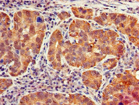 Immunofluorescent analysis of HepG2 cells using CAC08539 at dilution of 1:100 and Alexa Fluor 488-congugated AffiniPure Goat Anti-Rabbit IgG(H+L)