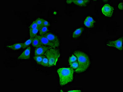 Western Blot; , Positive WB detected in: Hela whole cell lysate, Rat liver tissue, Mouse liver tissue; , All lanes: IFIT1 antibody at 4µg/ml; , Secondary; , Goat polyclonal to rabbit IgG at 1/50000 dilution; , Predicted band size: 56, 52 kDa; , Observed band size: 56 kDa;