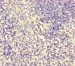Immunofluorescent analysis of HepG2 cells using CAC08564 at dilution of 1:100 and Alexa Fluor 488-congugated AffiniPure Goat Anti-Rabbit IgG(H+L)