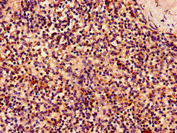 Immunofluorescent analysis of A549 cells using CAC08581 at dilution of 1:100 and Alexa Fluor 488-congugated AffiniPure Goat Anti-Rabbit IgG(H+L)