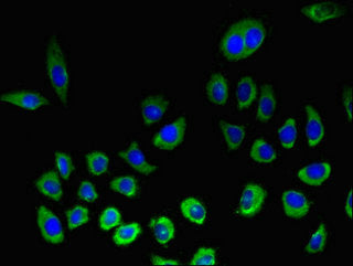 Western Blot; , Positive WB detected in: A549 whole cell lysate, HepG2 whole cell lysate; , All lanes: KLRK1 antibody at 3.7µg/ml; , Secondary; , Goat polyclonal to rabbit IgG at 1/50000 dilution; , Predicted band size: 26 kDa; , Observed band size: 34 kDa