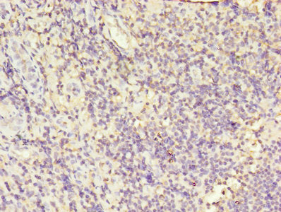Immunofluorescent analysis of A549 cells using CAC08589 at dilution of 1:100 and Alexa Fluor 488-congugated AffiniPure Goat Anti-Rabbit IgG(H+L)