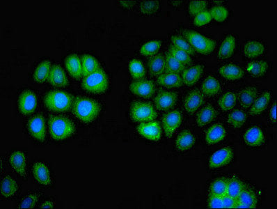 Lcp1 Polyclonal Antibody - image 4
