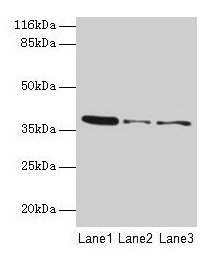 Immunohistochemistry of paraffin-embedded human kidney tissue using CAC08615 at dilution of 1:100