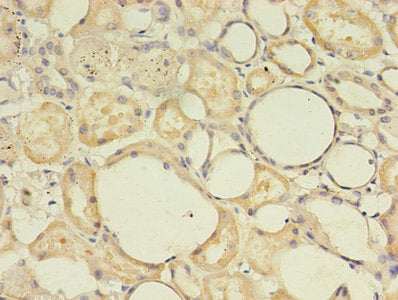 Immunohistochemistry of paraffin-embedded human testis tissue using CAC08615 at dilution of 1:100