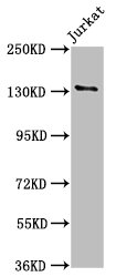 Immunofluorescence staining of HepG2 cells with CAC08678 at 1:125, counter-stained with DAPI. The cells were fixed in 4% formaldehyde, permeabilized using 0.2% Triton X-100 and blocked in 10% normal Goat Serum. The cells were then incubated with the antibody overnight at 4°C. The secondary antibody was Alexa Fluor 488-congugated AffiniPure Goat Anti-Rabbit IgG(H+L).