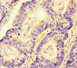 Immunohistochemistry of paraffin-embedded human skeletal muscle tissue using CAC08684 at dilution of 1:100