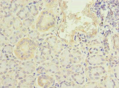Immunofluorescent analysis of PC-3 cells using CAC08716 at dilution of 1:100 and Alexa Fluor 488-congugated AffiniPure Goat Anti-Rabbit IgG(H+L)