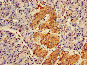 Immunohistochemistry of paraffin-embedded human spleen tissue using CAC08772 at dilution of 1:100