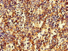 Immunofluorescent analysis of HepG2 cells using CAC08772 at dilution of 1:100 and Alexa Fluor 488-congugated AffiniPure Goat Anti-Rabbit IgG(H+L)