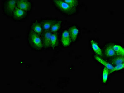 Rab27A Polyclonal Antibody - image 4