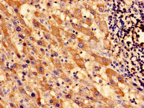 Immunofluorescent analysis of Hela cells using CAC08863 at dilution of 1:100 and Alexa Fluor 488-congugated AffiniPure Goat Anti-Rabbit IgG(H+L)