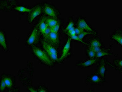 Socs3 Polyclonal Antibody - image 3