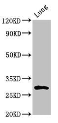 Immunohistochemistry of paraffin-embedded human brain tissue using CAC08890 at dilution of 1:100