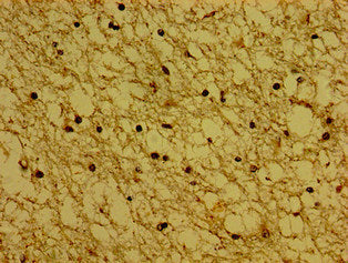 Immunofluorescence staining of U251 cells with CAC08890 at 1:145, counter-stained with DAPI. The cells were fixed in 4% formaldehyde, permeabilized using 0.2% Triton X-100 and blocked in 10% normal Goat Serum. The cells were then incubated with the antibody overnight at 4°C. The secondary antibody was Alexa Fluor 488-congugated AffiniPure Goat Anti-Rabbit IgG(H+L).