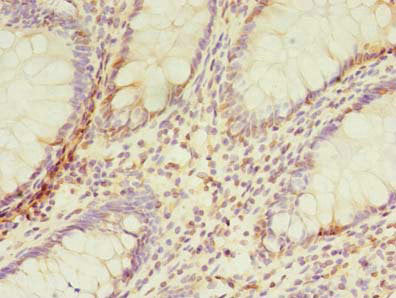 Immunohistochemistry of paraffin-embedded human placenta tissue using CAC08916 at dilution of 1:100