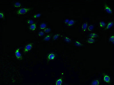 Tmem165 Polyclonal Antibody - image 5