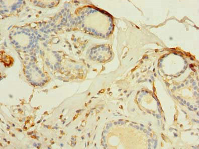 Immunohistochemistry of paraffin-embedded human skin tissue using CAC08917 at dilution of 1:100