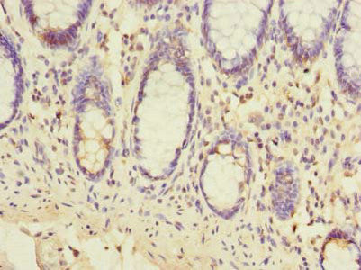 Immunofluorescent analysis of MCF-7 cells using CAC08932 at dilution of 1:100 and Alexa Fluor 488-congugated AffiniPure Goat Anti-Rabbit IgG(H+L)