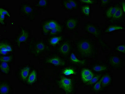 Tspan5 Polyclonal Antibody - image 3