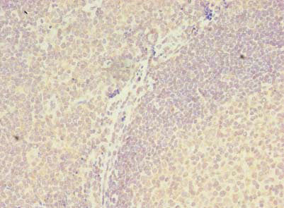 Immunohistochemistry of paraffin-embedded human pancreatic tissue using CAC08988 at dilution of 1:100