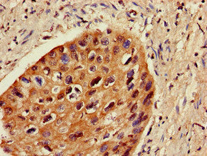 Immunofluorescent analysis of Hela cells using CAC09005 at dilution of 1:100 and Alexa Fluor 488-congugated AffiniPure Goat Anti-Rabbit IgG(H+L)