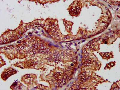Immunofluorescence staining of Hela cells with CAC09027 at 1:400, counter-stained with DAPI. The cells were fixed in 4% formaldehyde, permeabilized using 0.2% Triton X-100 and blocked in 10% normal Goat Serum. The cells were then incubated with the antibody overnight at 4°C. The secondary antibody was Alexa Fluor 488-congugated AffiniPure Goat Anti-Rabbit IgG(H+L).