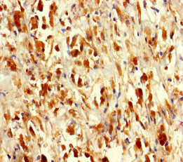 Sars Polyclonal Antibody - image 4