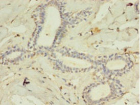 Acsl4 Polyclonal Antibody - image 4
