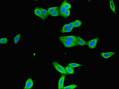 Western Blot; , Positive WB detected in: Rat heart tissue; , All lanes: ICAM1 antibody at 2.4µg/ml; , Secondary; , Goat polyclonal to rabbit IgG at 1/50000 dilution; , Predicted band size: 58 kDa; , Observed band size: 58 kDa;