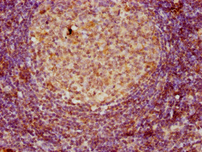 Immunofluorescence staining of PC-3 cells with CAC09127 at 1:53, counter-stained with DAPI. The cells were fixed in 4% formaldehyde, permeabilized using 0.2% Triton X-100 and blocked in 10% normal Goat Serum. The cells were then incubated with the antibody overnight at 4°C. The secondary antibody was Alexa Fluor 488-congugated AffiniPure Goat Anti-Rabbit IgG(H+L).