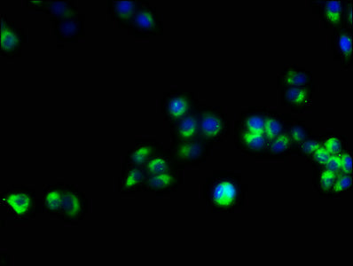 Western blot; , All lanes: CD3E antibody at 1.5µg/ml + Jurkat whole cell lysate; , Secondary; , Goat polyclonal to rabbit IgG at 1/10000 dilution; , Predicted band size: 24 kDa; , Observed band size: 24 kDa