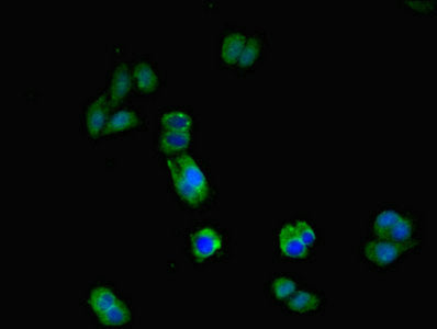 Il17Ra Polyclonal Antibody - image 3