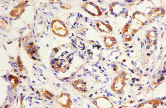 Immunofluorescent analysis of HepG2 cells using CAC09181 at dilution of 1:100 and Alexa Fluor 488-congugated AffiniPure Goat Anti-Rabbit IgG(H+L)