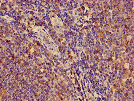 Immunofluorescent analysis of Hela cells using CAC09183 at dilution of 1:100