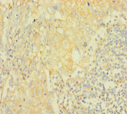 Immunofluorescence staining of A549 cells with CAC09191 at 1:466, counter-stained with DAPI. The cells were fixed in 4% formaldehyde, permeabilized using 0.2% Triton X-100 and blocked in 10% normal Goat Serum. The cells were then incubated with the antibody overnight at 4°C. The secondary antibody was Alexa Fluor 488-congugated AffiniPure Goat Anti-Rabbit IgG(H+L).