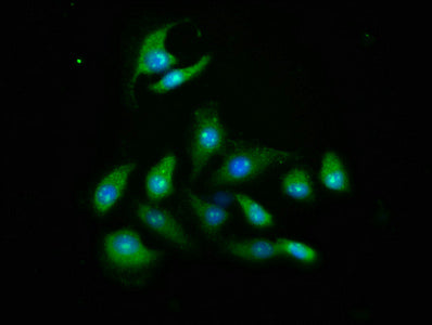Akt2 Polyclonal Antibody - image 4