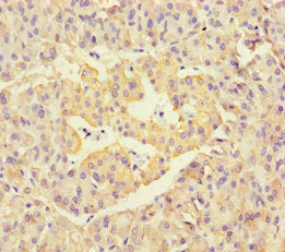 Neu1 Polyclonal Antibody - image 4